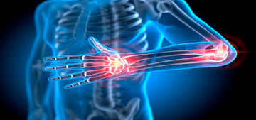 Preventing Tennis Elbow in Pickleball: Why Your Grip Might Be the Problem